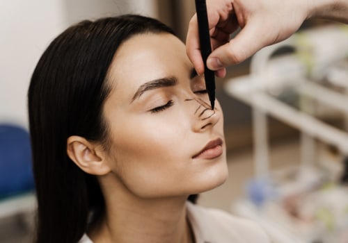 Expert Tips for Financing Your Rhinoplasty